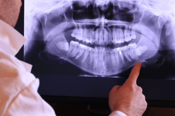 Best Chipped Tooth Repair Near Me  in Fellsmere, FL